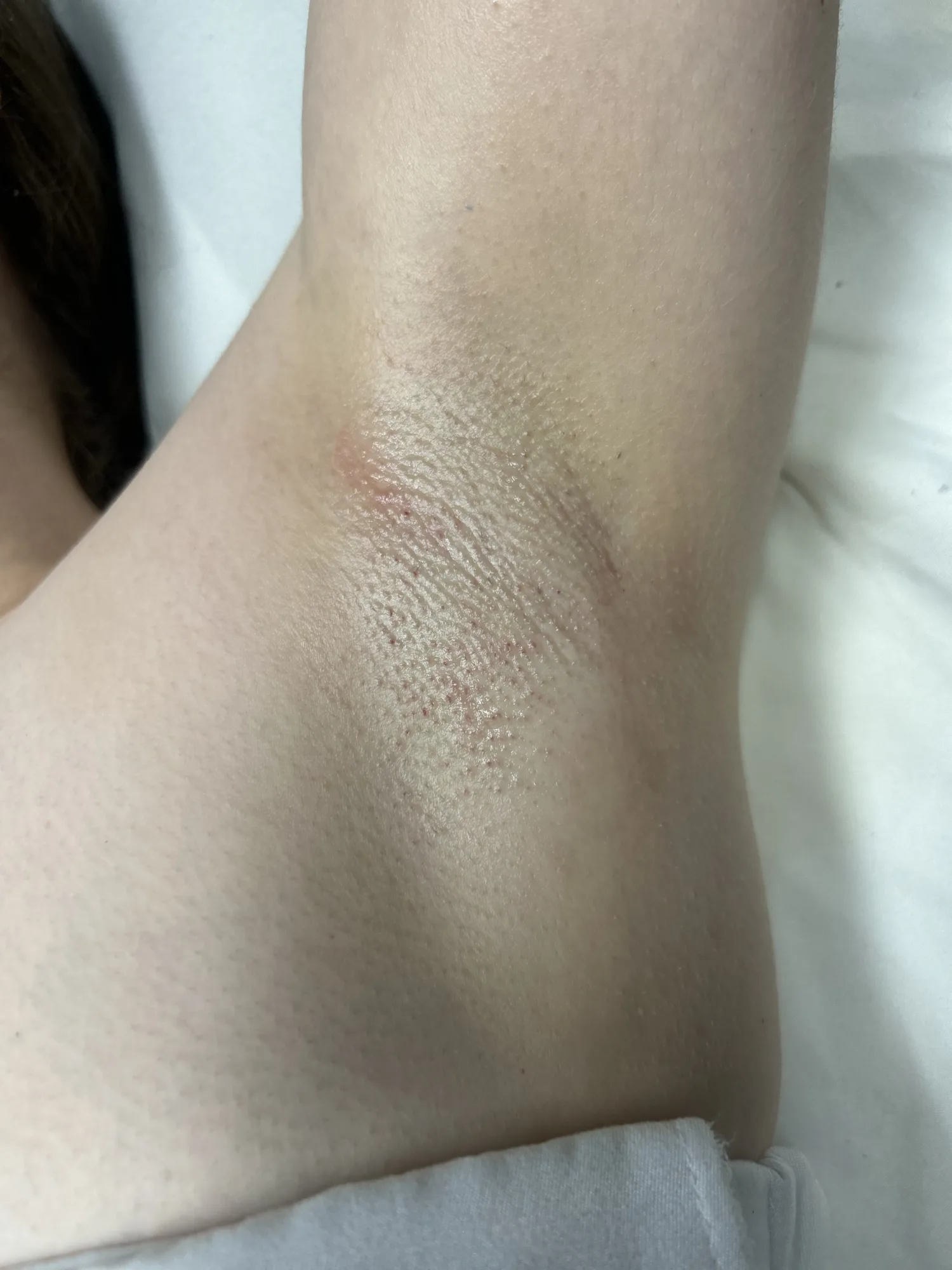 Underarm Wax